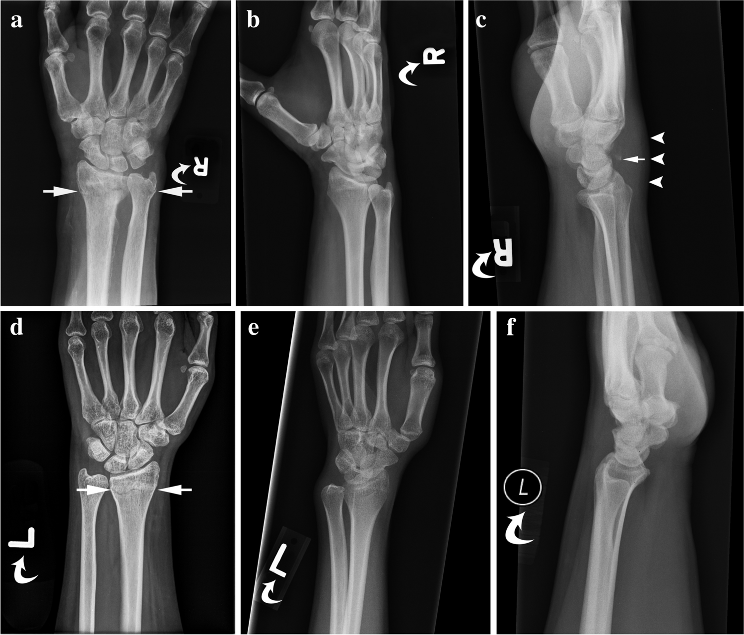 Improved Automated Quality Control of Skeletal Wrist Radiographs Using Deep Multitask Learning