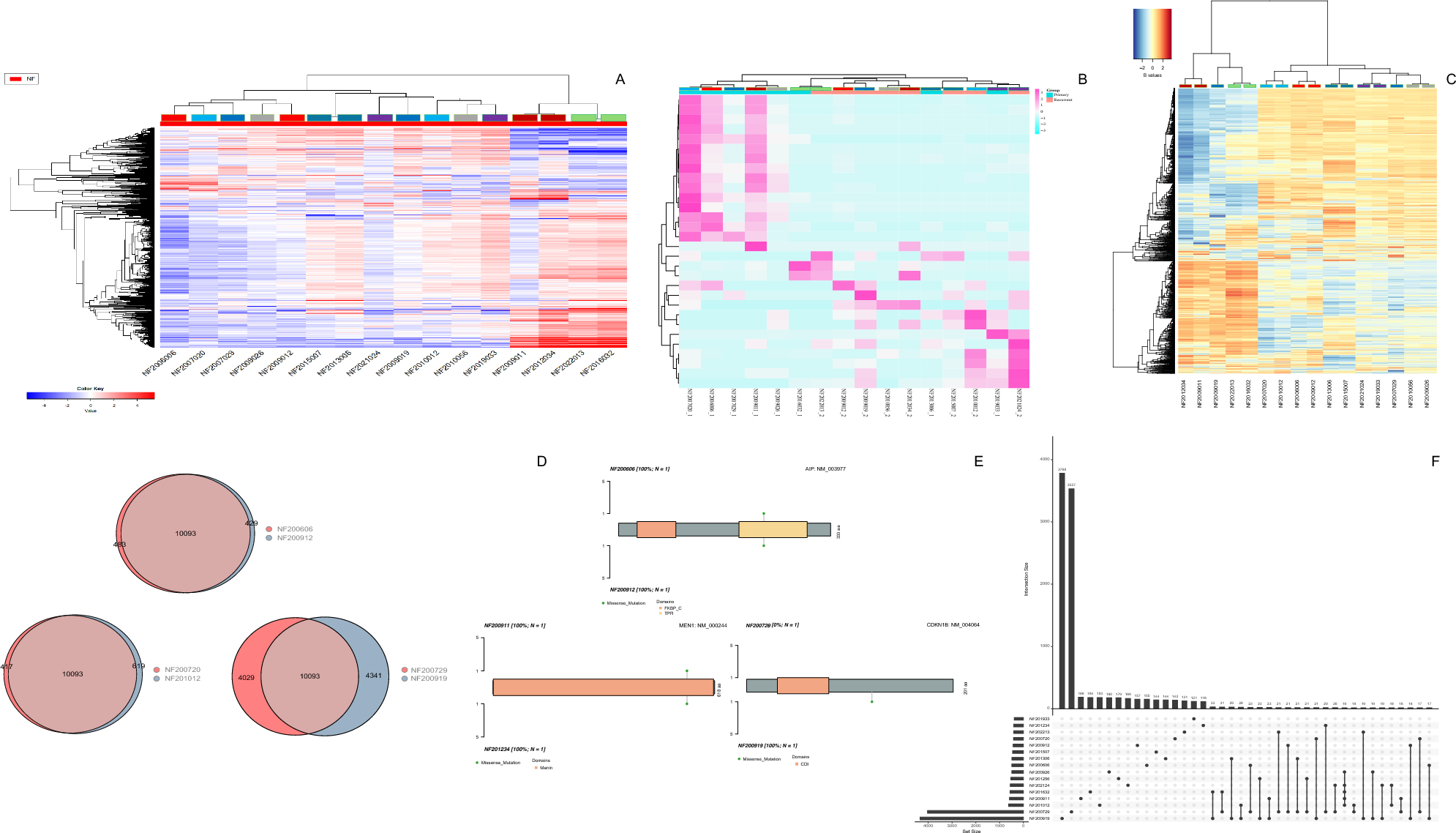 Longitudinal multiomics analysis of aggressive pituitary neuroendocrine tumors: comparing primary and recurrent tumors from the same patient, reveals genomic stability and heterogeneous transcriptomic profiles with alterations in metabolic pathways