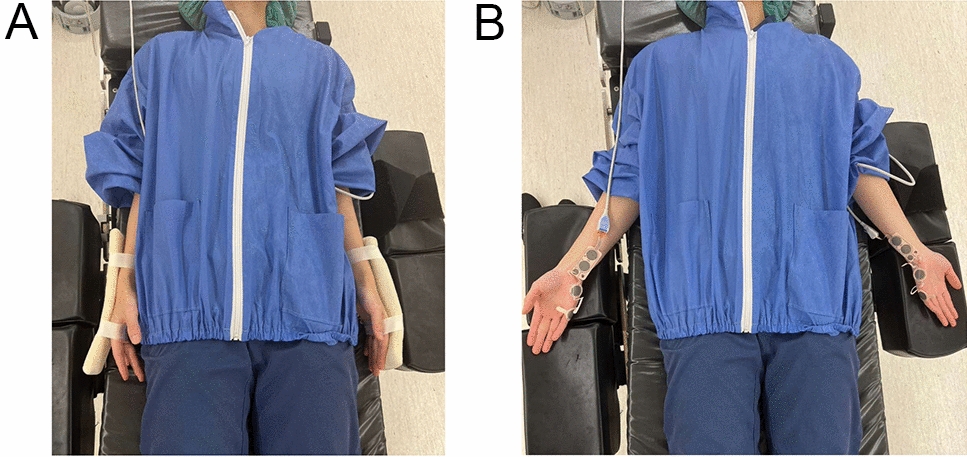 A novel stimulating electrode attachment method designed to maintain electromyography-based neuromuscular monitoring detectability during laparoscopic surgery: a single-center randomized, double-blind, controlled pilot study