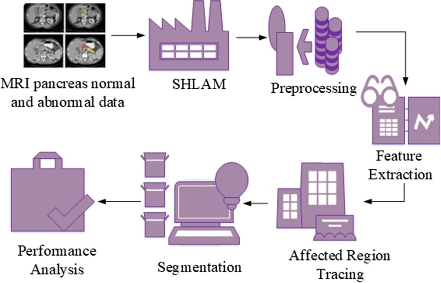 Optimized Spatial Transformer for Segmenting Pancreas Abnormalities