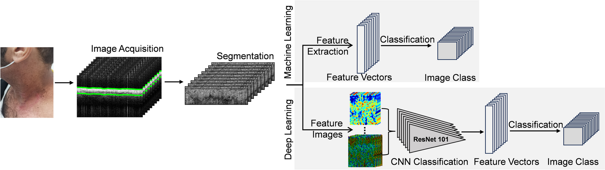 Feature-Based vs. Deep-Learning Fusion Methods for the In Vivo Detection of Radiation Dermatitis Using Optical Coherence Tomography, a Feasibility Study