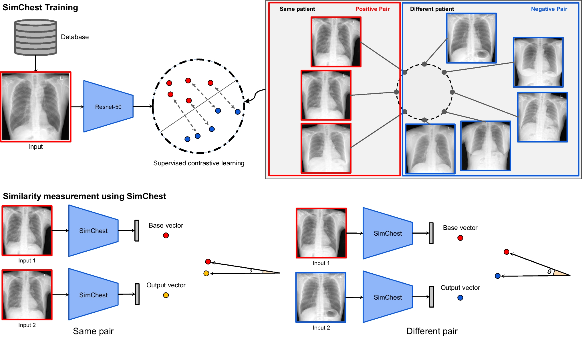 Screening Patient Misidentification Errors Using a Deep Learning Model of Chest Radiography: A Seven Reader Study