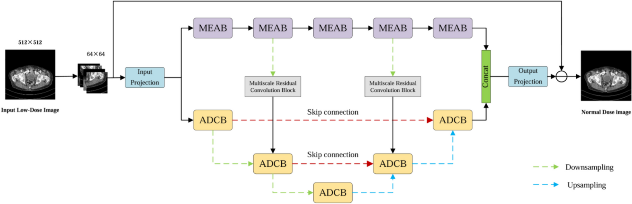 A Novel Network for Low-Dose CT Denoising Based on Dual-Branch Structure and Multi-Scale Residual Attention