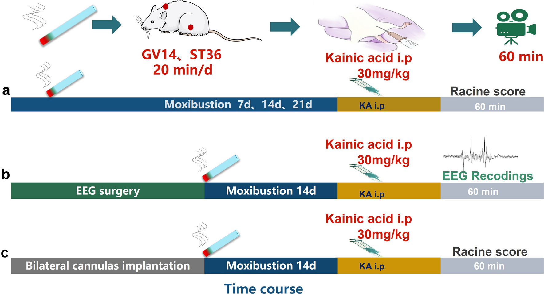 Moxibustion pre-treatment attenuates seizure severity during status epilepticus and counteracts the proconvulsant function of the purinergic P2X7 receptor