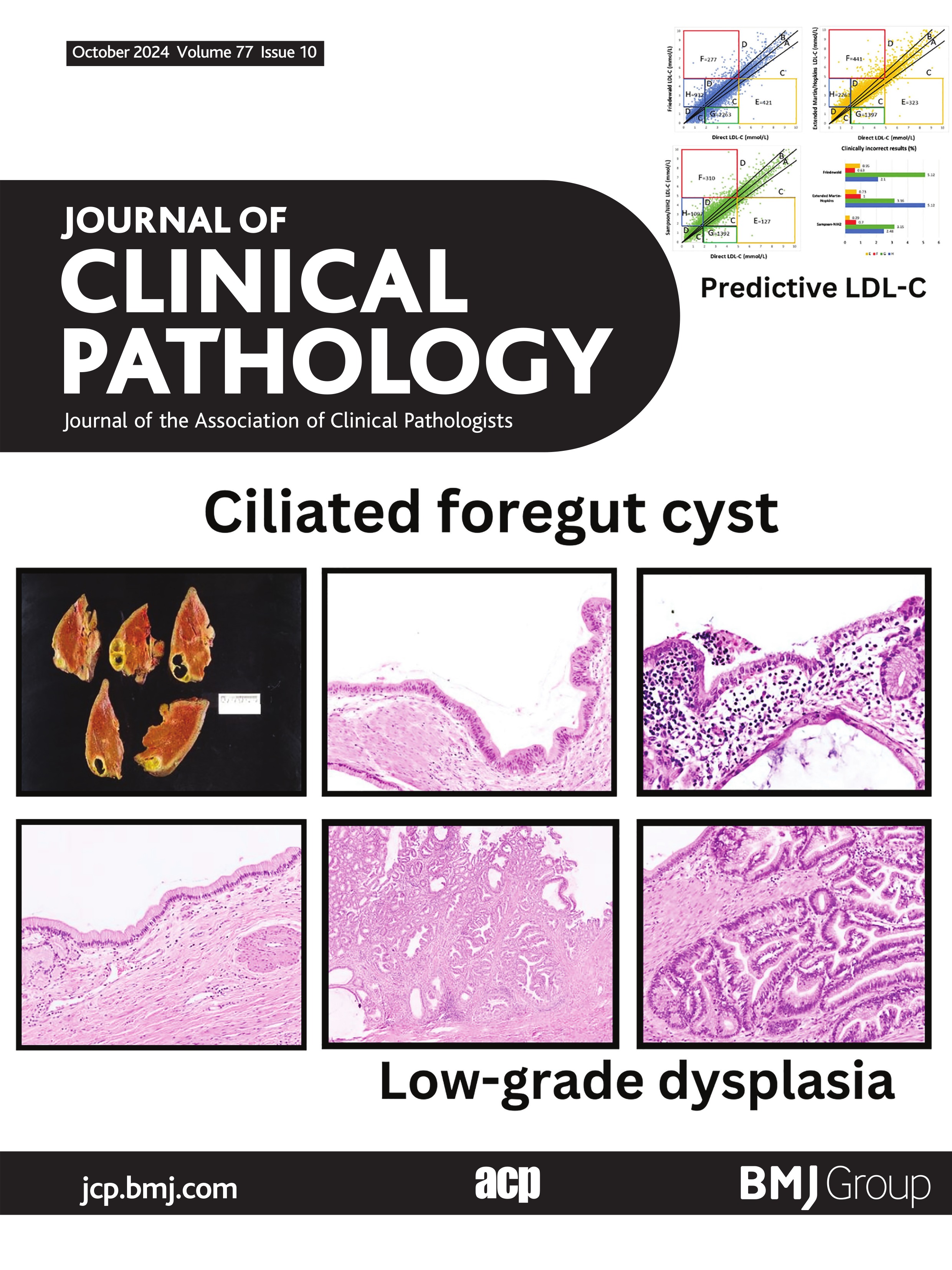 Comparative analysis of antigen-presenting cells in gingival tissues in healthy and periodontitis patients