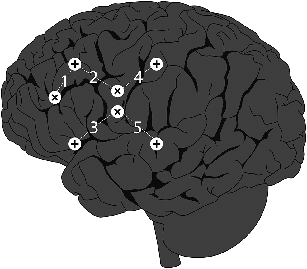 Short-term cortical activation changes associated with postural compensation in swallowing