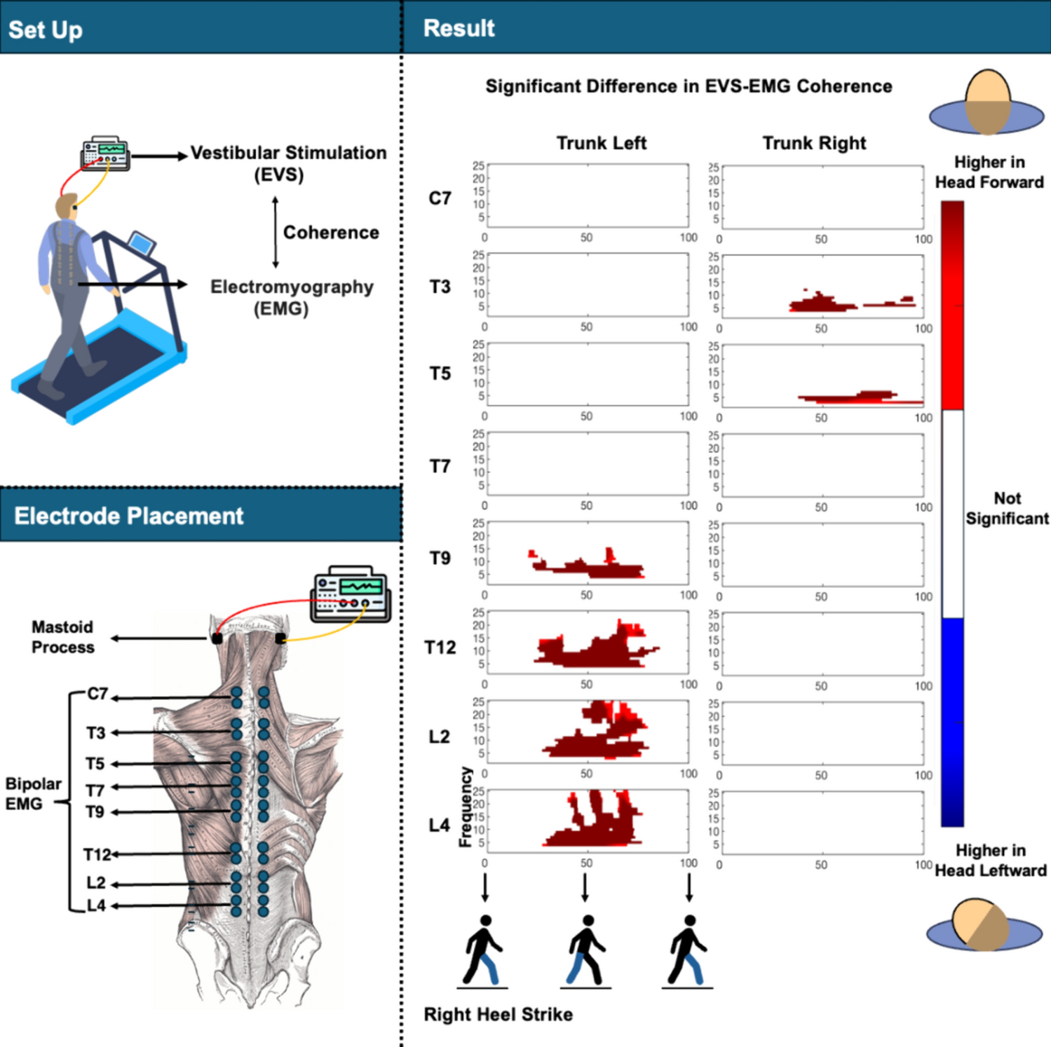 The effect of head orientation on vestibular signal-based modulation of paraspinal muscle activity during walking