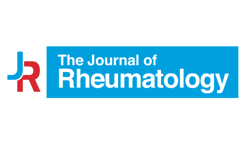 A Rare Diagnosis of Infiltrative Muscle Disease in a Patient With Multiple Joint Pain and Fever