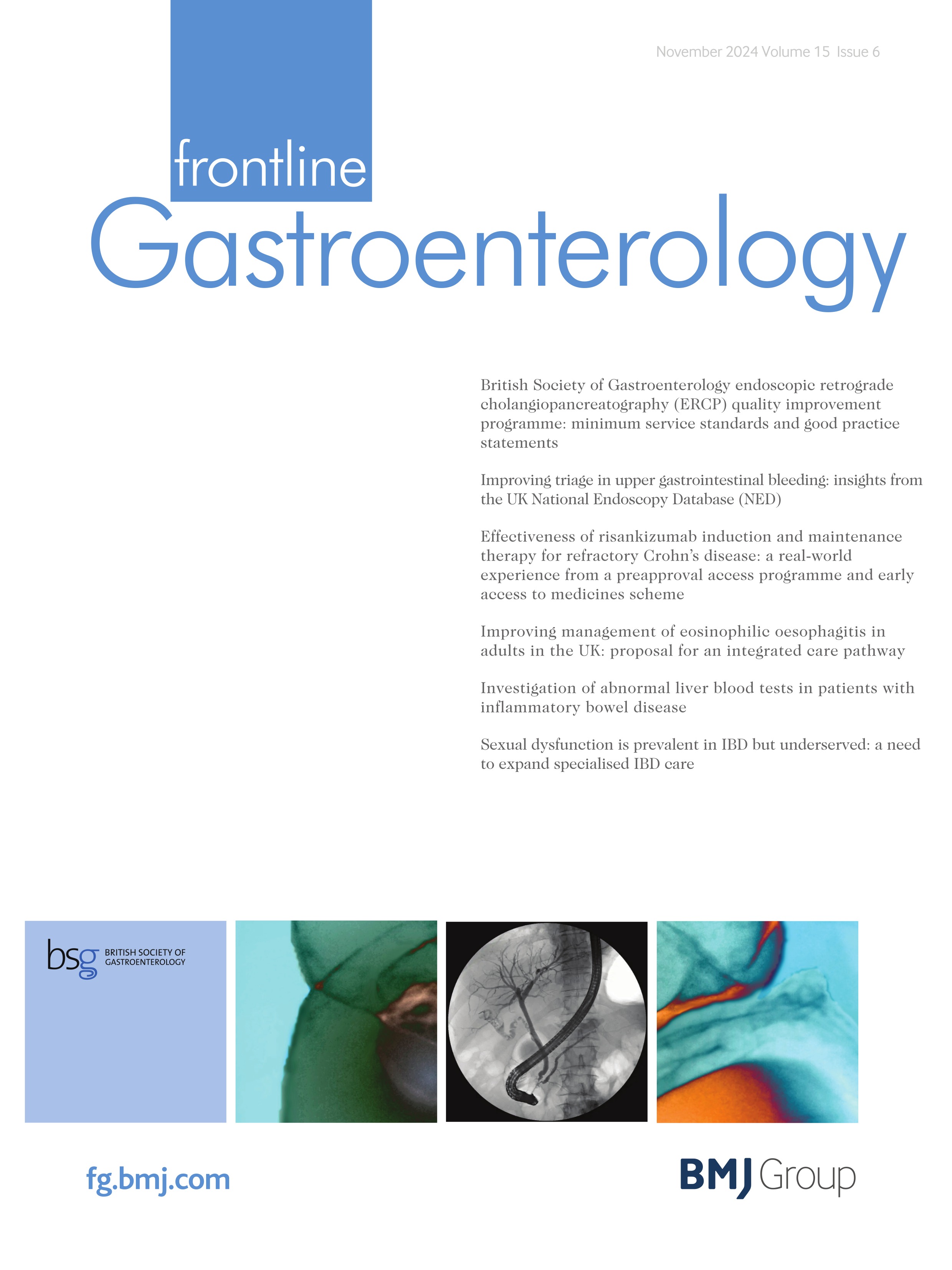 British Society of Gastroenterology Endoscopic Retrograde Cholangiopancreatography (ERCP) Quality Improvement Programme: minimum service standards and good practice statements