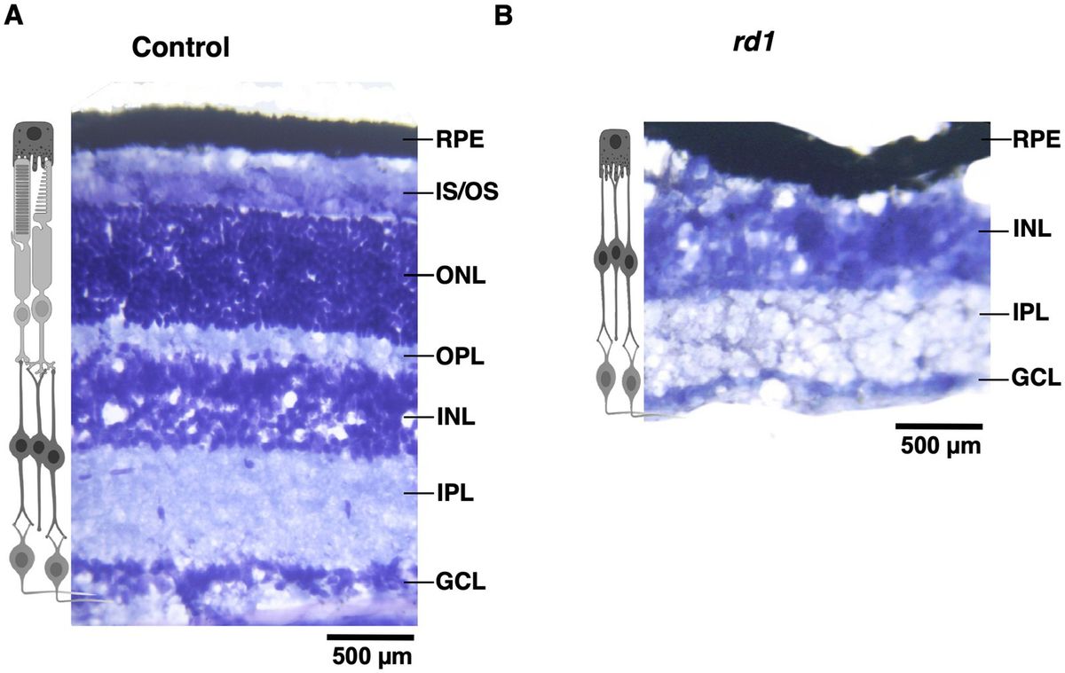 Deprivation of visual input alters specific subset of inhibitory neurons and affect thalamic afferent terminals in V1 of rd1 mouse