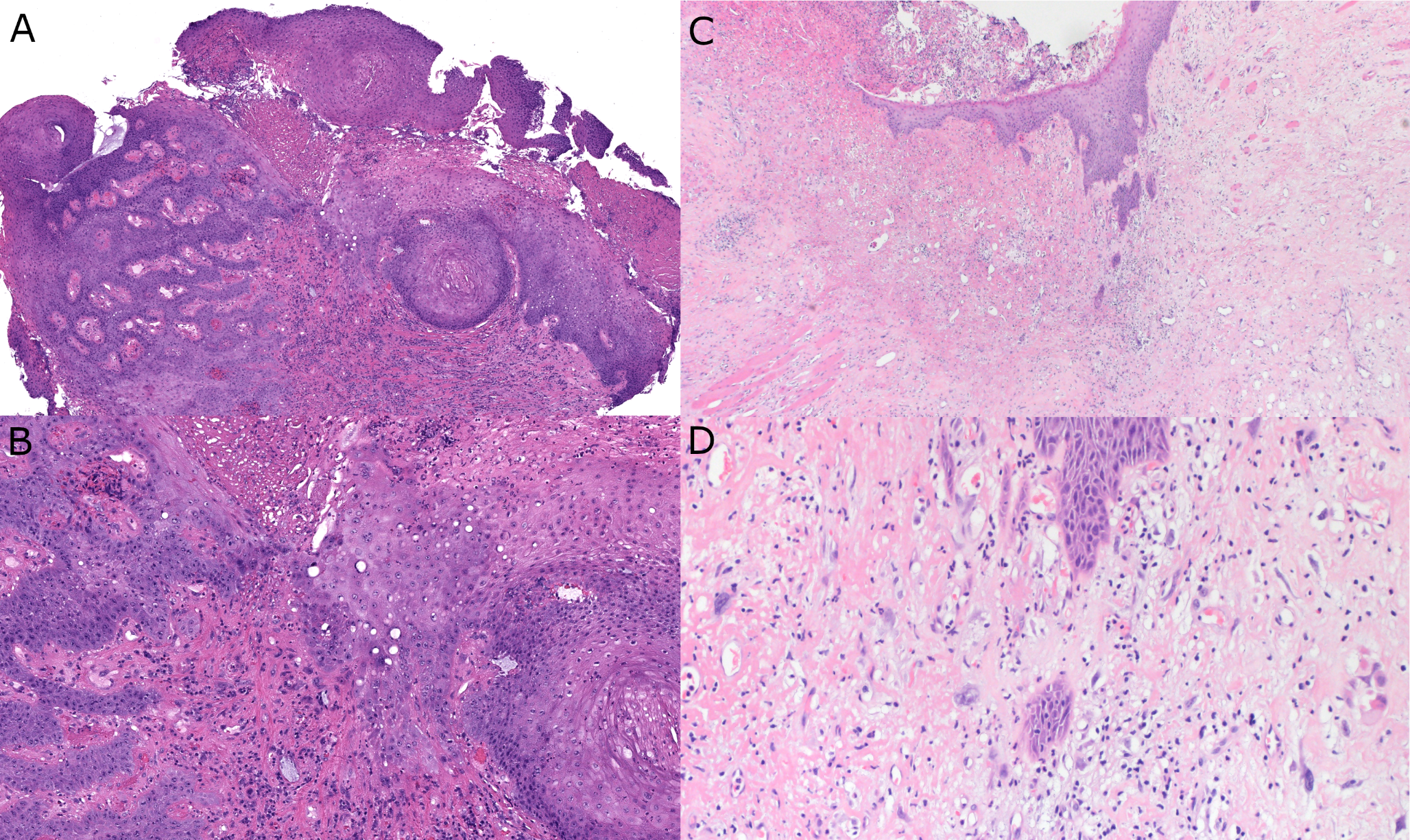 “So You Made a Mistake” – The Path Forward Through Surgical Pathology Errors by Extreme Ownership and a Focus on the Patient