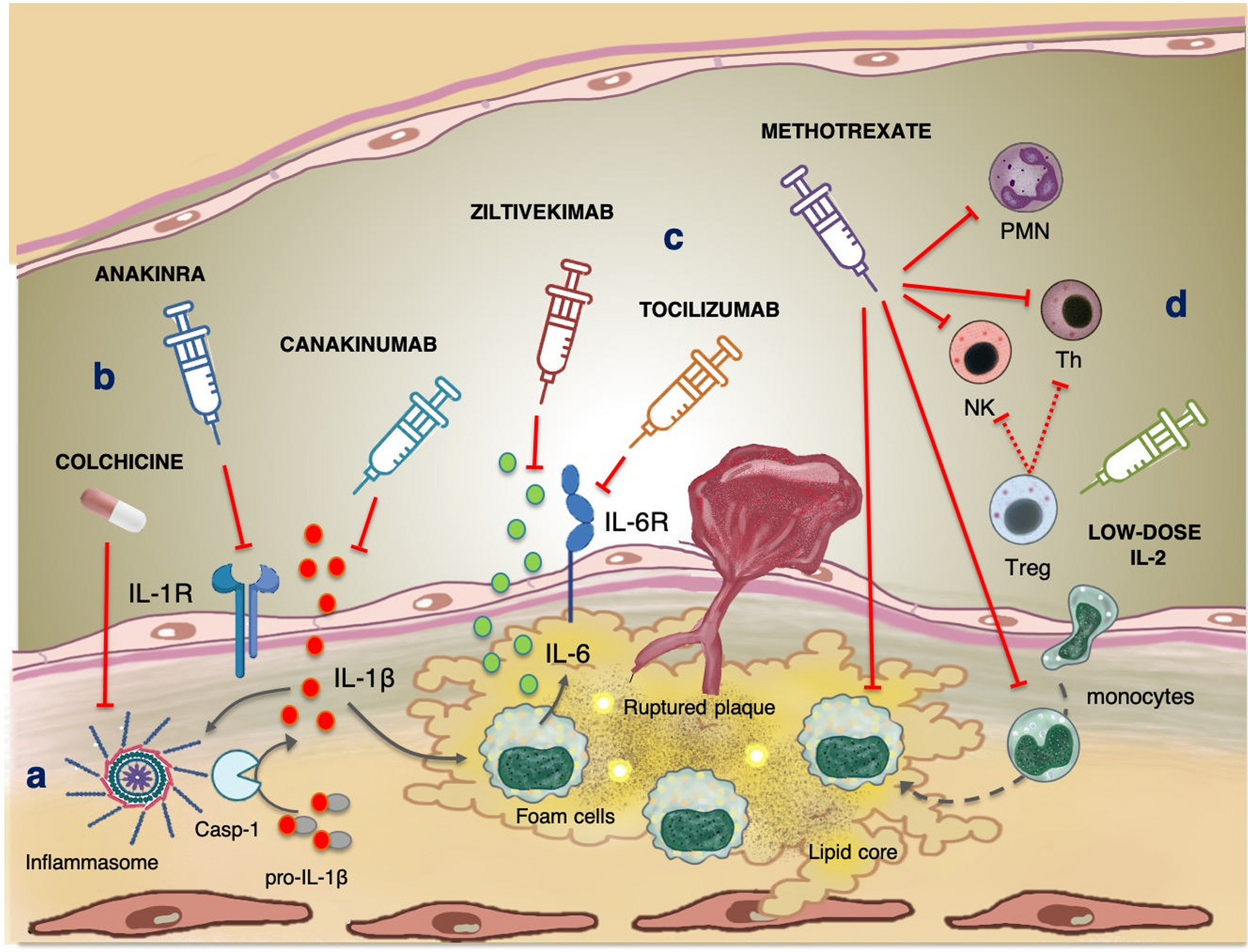 Targeting Inflammatory Pathways in Atherosclerosis: Exploring New Opportunities for Treatment