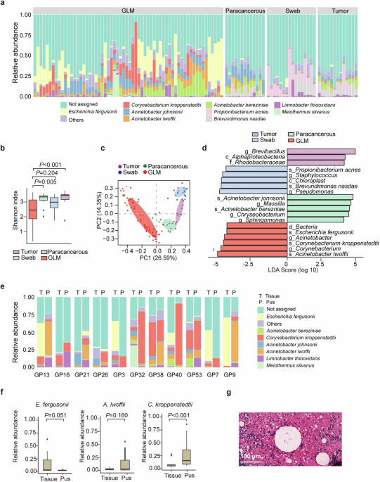 Corynebacterium parakroppenstedtii secretes a novel glycolipid to promote the development of granulomatous lobular mastitis