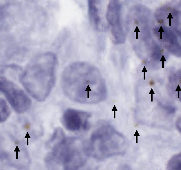 Deep Learning Segmentation of Chromogenic Dye RNAscope From Breast Cancer Tissue