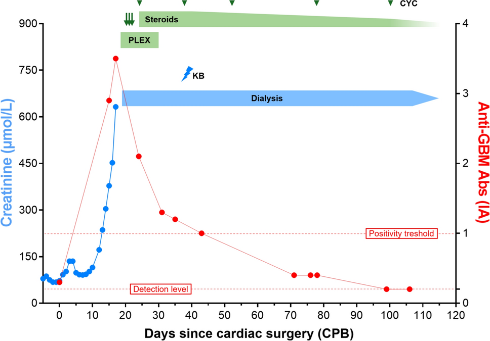 Anti-GBM disease fueled by cardiopulmonary bypass, a lesson for the clinical nephrologist