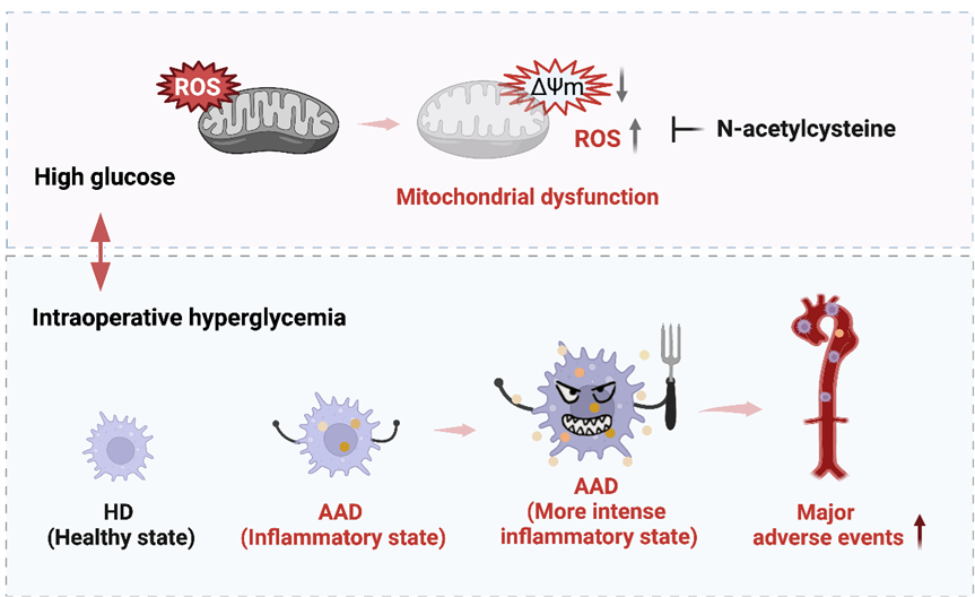 Monocytes perturbation implicated in the association of stress hyperglycemia with postoperative poor prognosis in non-diabetic patients with Stanford type-A acute aortic dissection