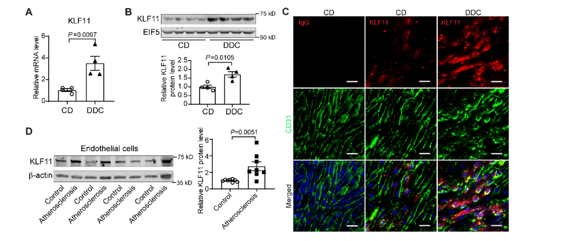 Endothelial KLF11 is a novel protector against diabetic atherosclerosis