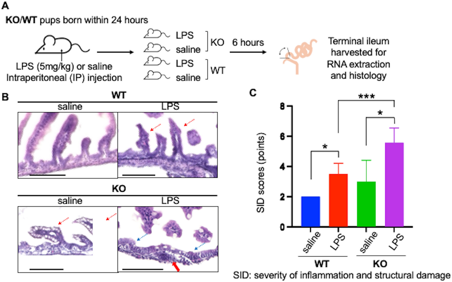 Angiopoietin-1 attenuates lipopolysaccharide-induced endotoxemia in a Hirschsprung’s disease murine model by improving intestinal vascular integrity: implications for treating postoperative Hirschsprung-associated enterocolitis