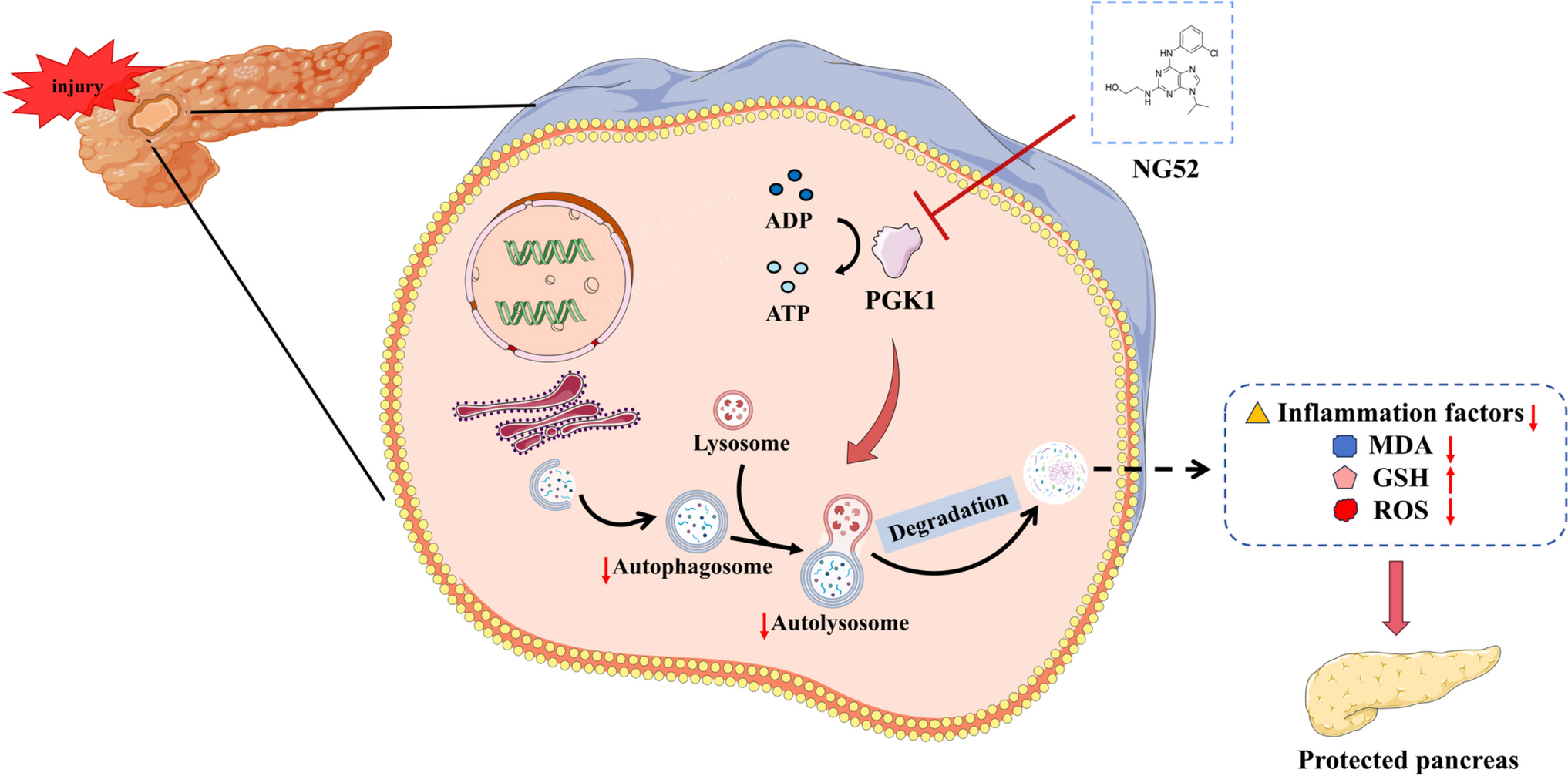 Pharmacological Inhibition of Phosphoglycerate Kinase 1 Reduces OxiDative Stress and Restores Impaired Autophagy in Experimental Acute Pancreatitis