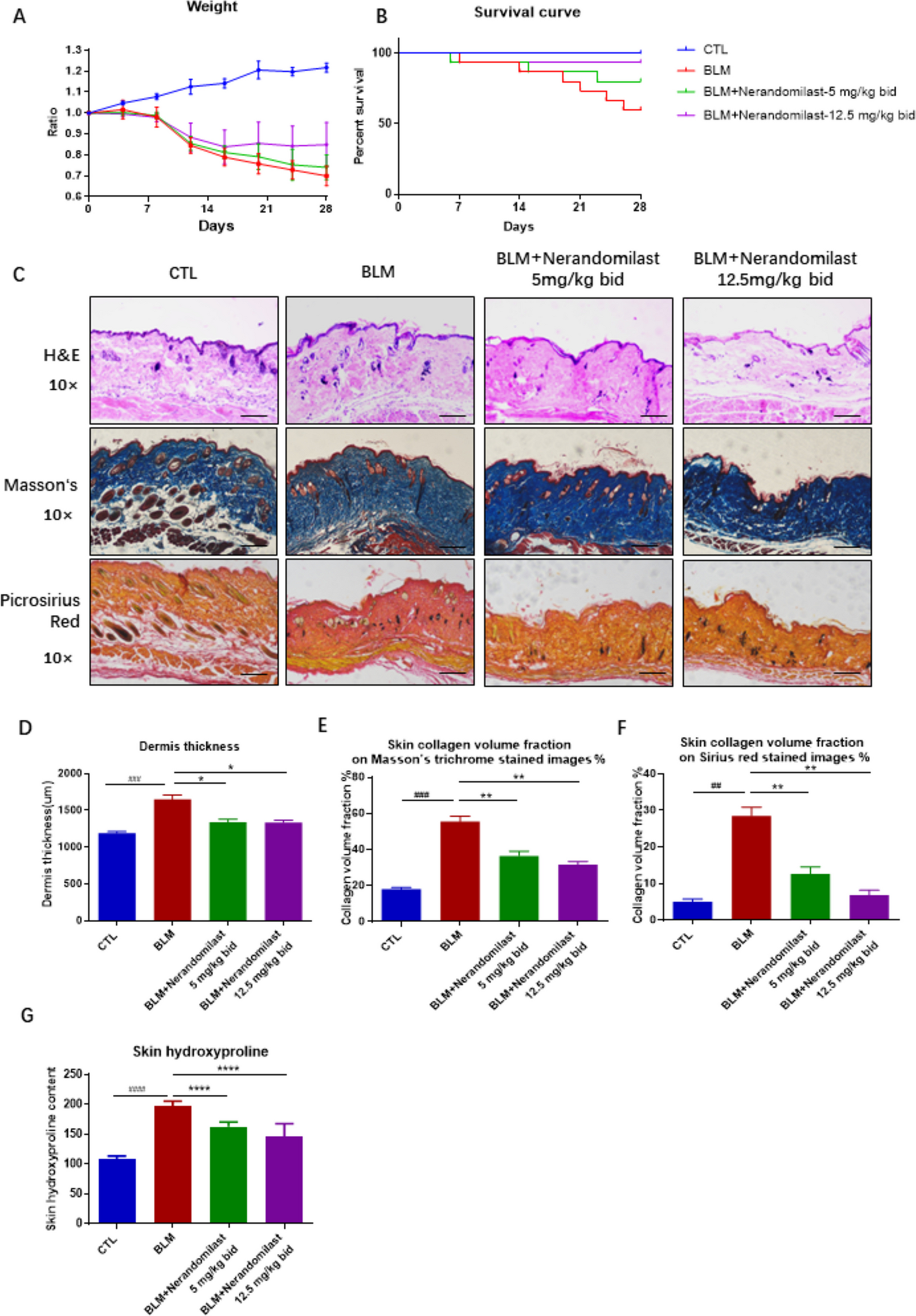 Nerandomilast Improves Bleomycin-Induced Systemic Sclerosis-Associated Interstitial Lung Disease in Mice by Regulating the TGF-β1 Pathway