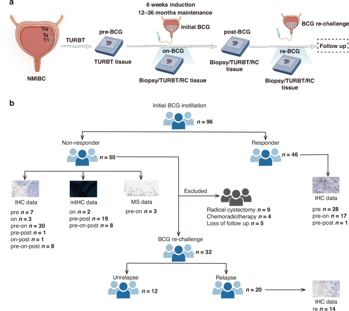 Temporal dynamics of immune cell patterns in bladder cancer patients receiving Bacillus Calmette-Guérin therapy