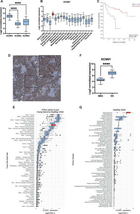 Chimeric protein EWS::FLI1 drives cell proliferation in Ewing Sarcoma via aberrant expression of KCNN1/SK1 and dysregulation of calcium signaling