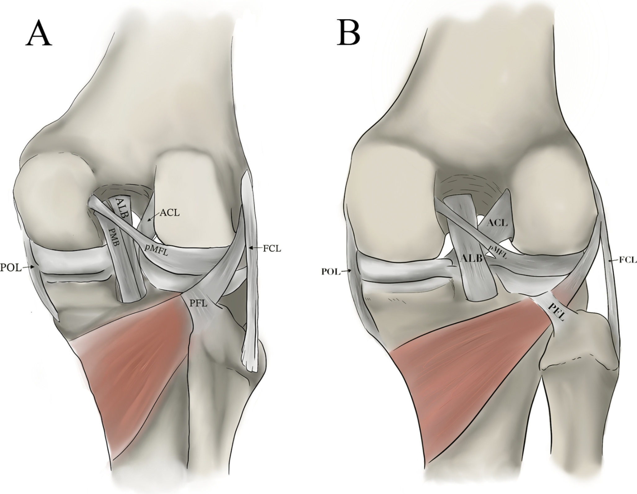 Clinical efficacy of arthroscopic single-bundle versus double-bundle reconstruction of the posterior cruciate ligament: a retrospective study