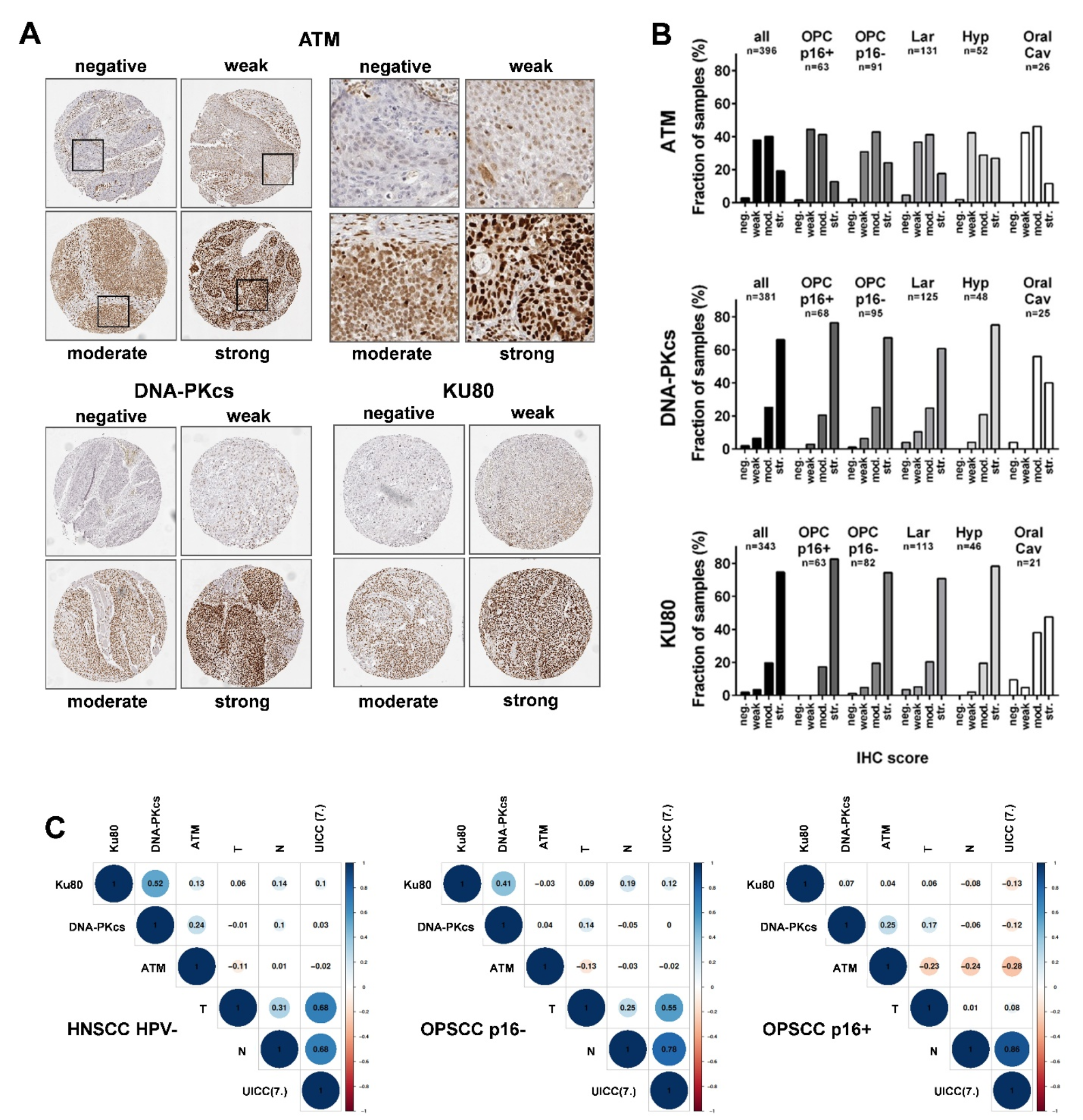 Tissue microarray analyses of the essential DNA repair factors ATM, DNA-PKcs and Ku80 in head and neck squamous cell carcinoma