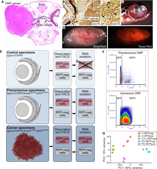 Profiling the cancer-prone microenvironment in a zebrafish model for MPNST