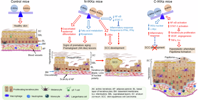 Nuclear versus cytoplasmic IKKα signaling in keratinocytes leads to opposite skin phenotypes and inflammatory responses, and a different predisposition to cancer