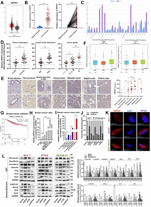 Hypoxia induced cellular and exosomal RPPH1 promotes breast cancer angiogenesis and metastasis through stabilizing the IGF2BP2/FGFR2 axis