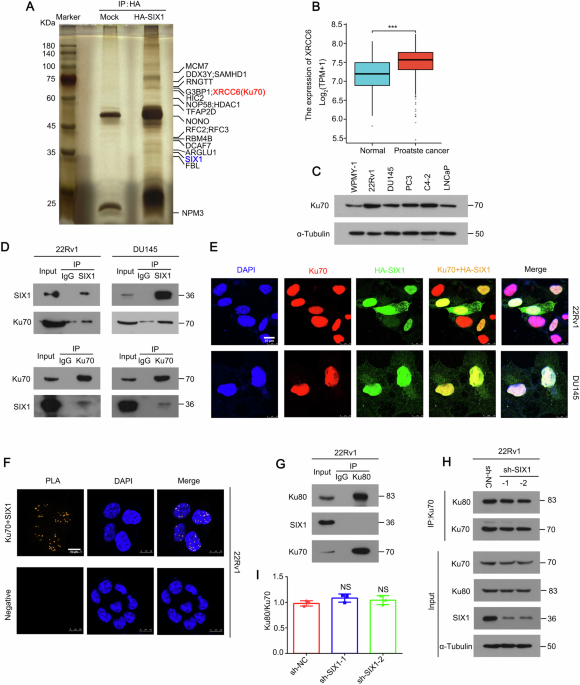 The Ku70-SIX1-GPT2 axis regulates alpha-ketoglutarate metabolism to drive progression of prostate cancer