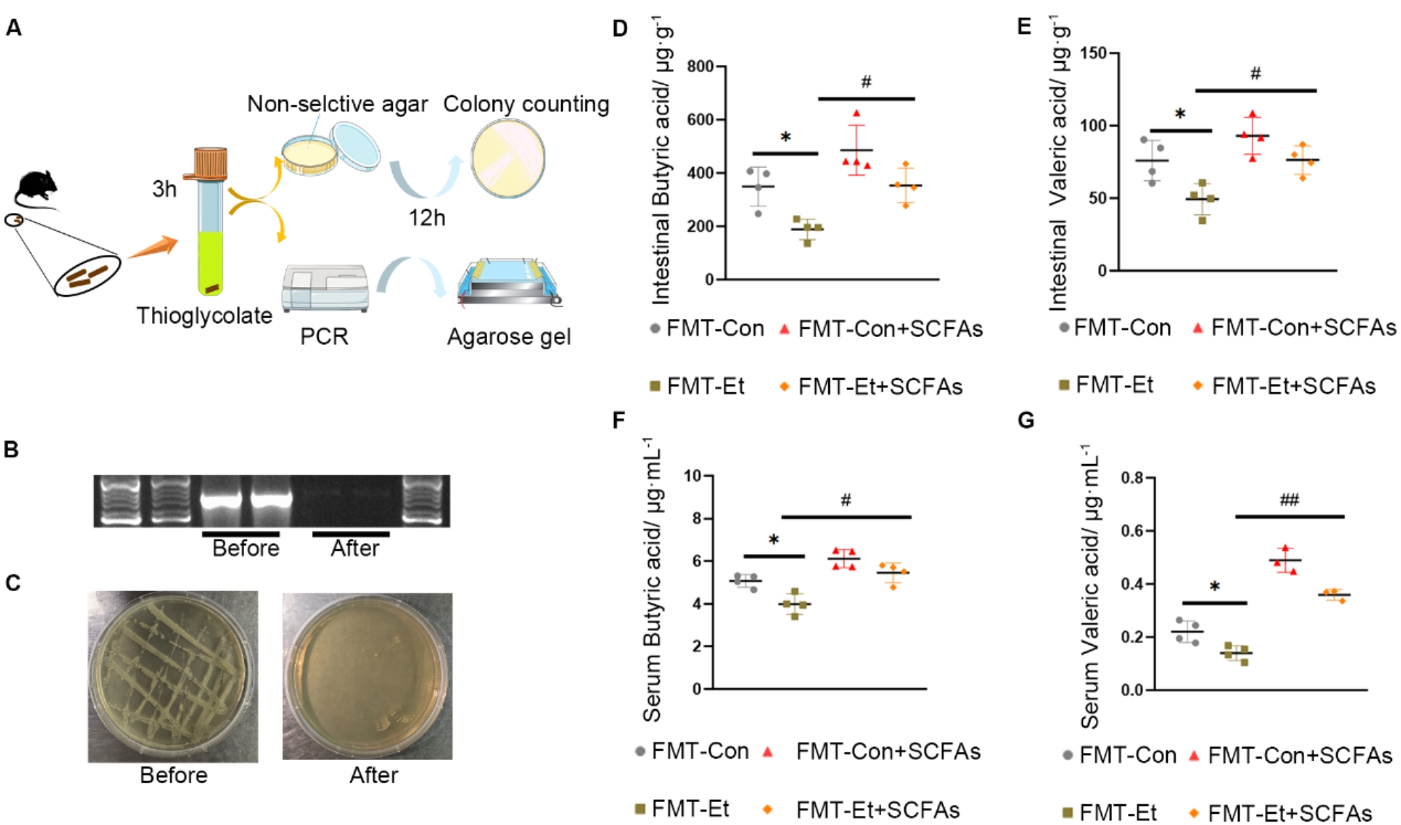 Gut microbiota modulates depressive-like behaviors induced by chronic ethanol exposure through short-chain fatty acids