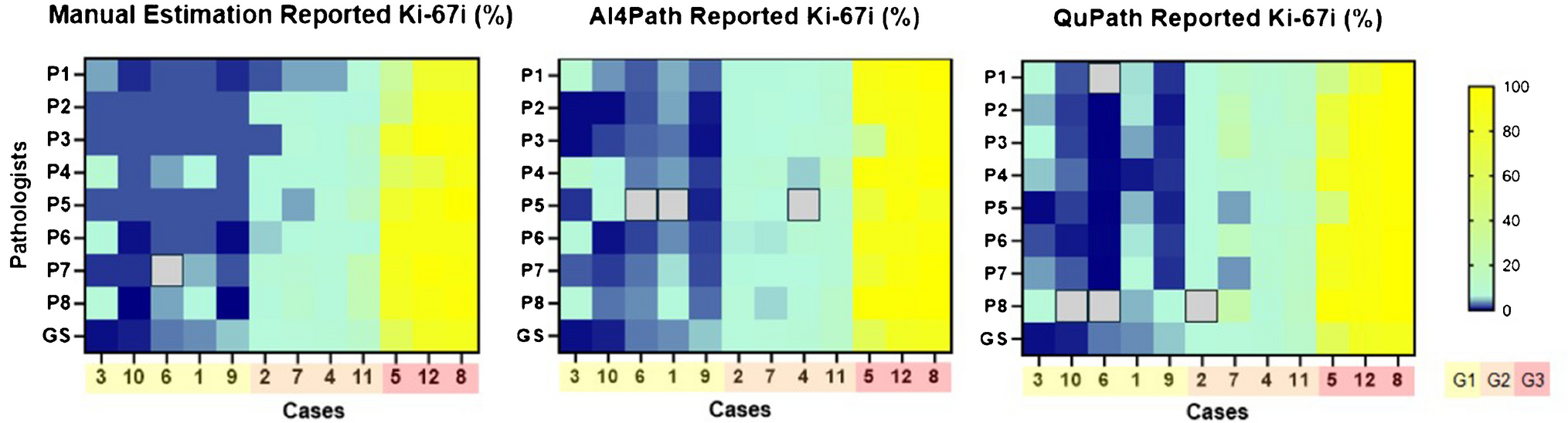 Determination of Ki-67 indices in neuroendocrine tumours of the gastrointestinal tract: the past, the present, and the future