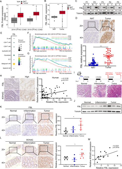 Enhancing low-dose radiotherapy efficacy with PARP inhibitors via FBL-mediated oxidative stress response in colorectal cancer