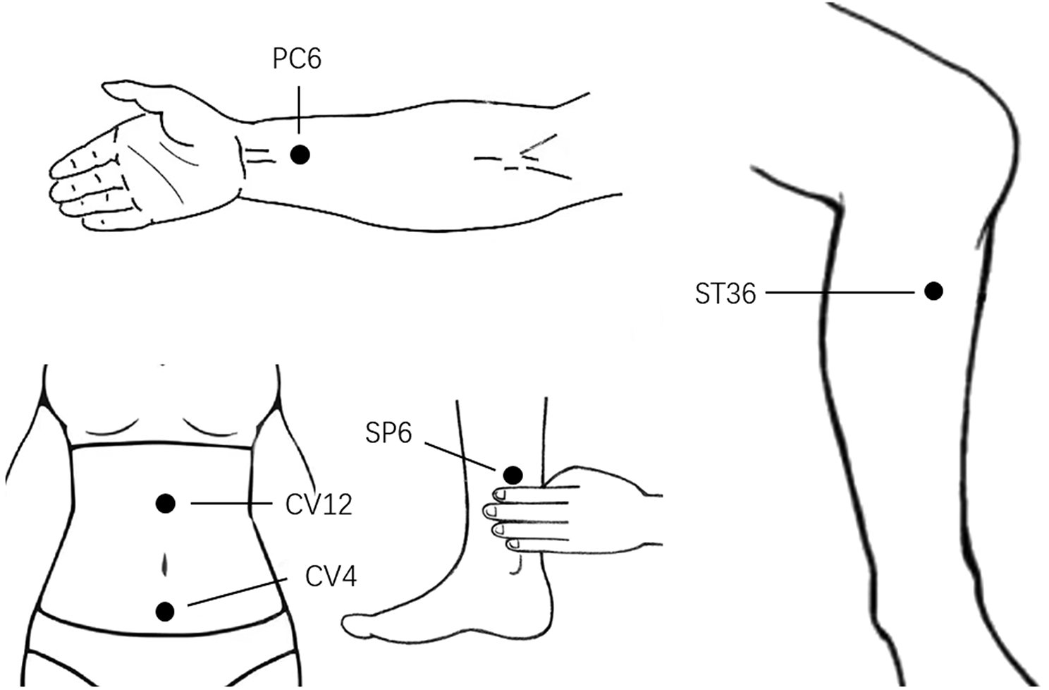 The impact of acupuncture on the brain function of patients with mild to moderate major depressive disorder: a randomized controlled trial protocol