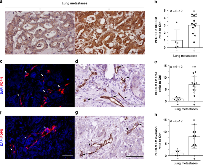 VEGF-C propagates ‘onward’ colorectal cancer metastasis from liver to lung