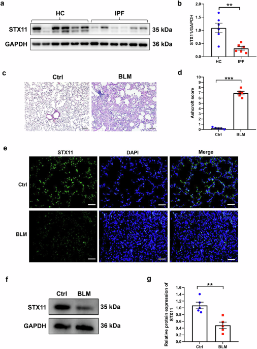 Overexpression of STX11 alleviates pulmonary fibrosis by inhibiting fibroblast activation via the PI3K/AKT/mTOR pathway