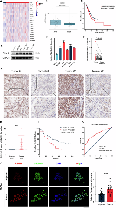 RBM15 facilitates osimertinib resistance of lung adenocarcinoma through m6A-dependent epigenetic silencing of SPOCK1