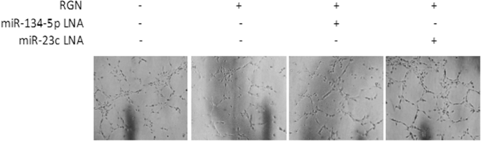 Correction: Regucalcin promotes dormancy of prostate cancer