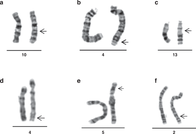 Prenatal diagnosis and genetic analysis: rare familial chromosomal duplications larger than 5 Mb without disease phenotypes