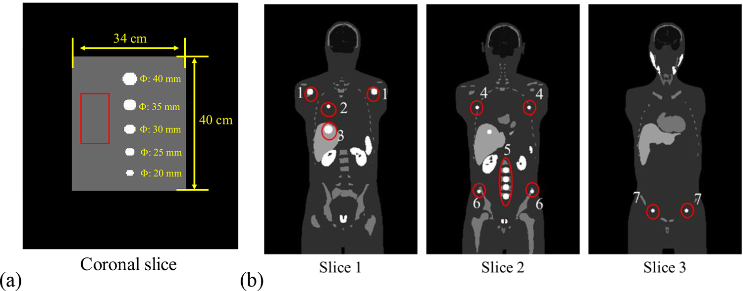 Partial volume correction for Lu-177-PSMA SPECT