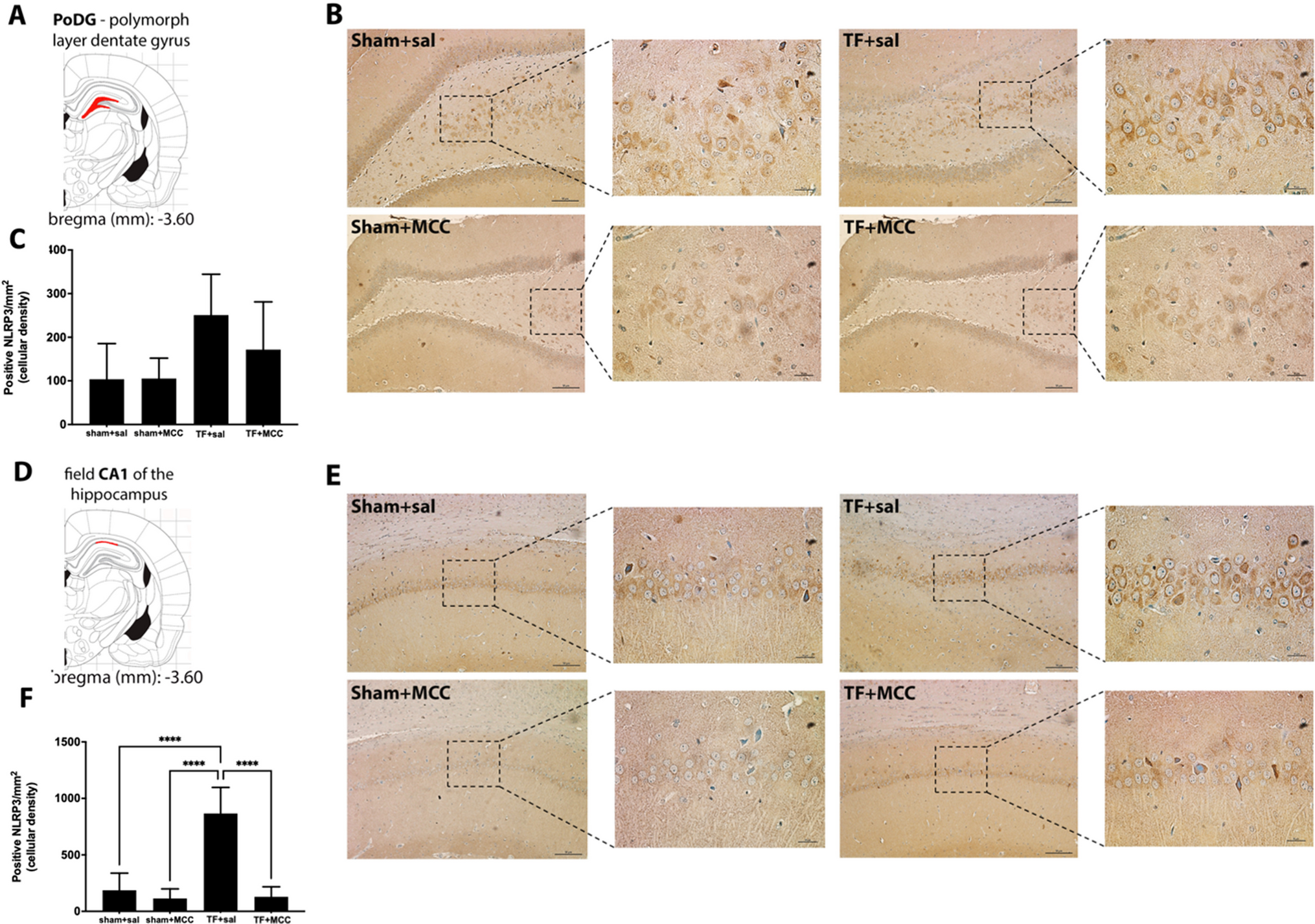 Oxidative stress and mitochondrial dysfunction contributes to postoperative cognitive dysfunction in elderly rats dependent on NLRP3 activation