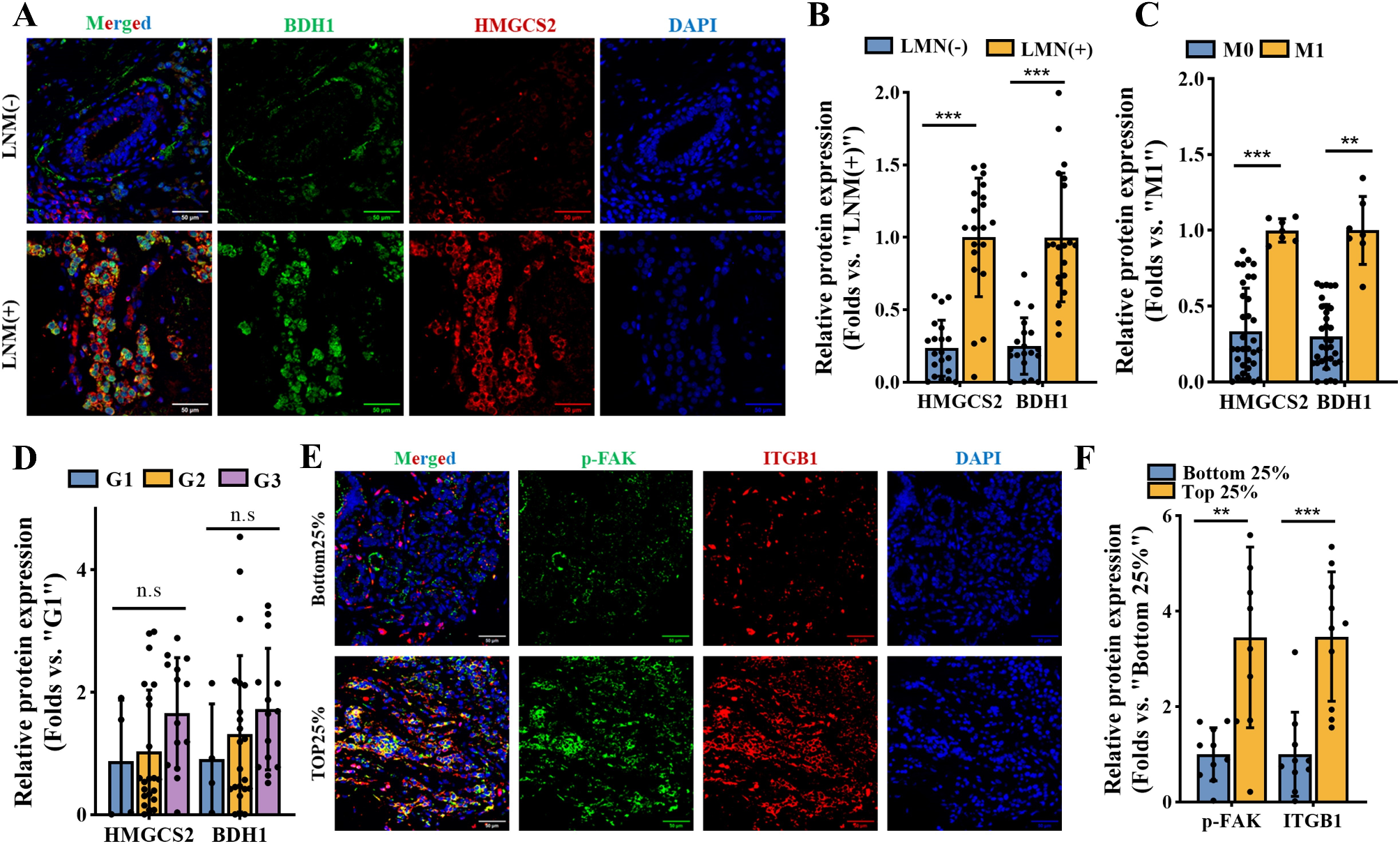 Ketogenesis promotes triple-negative breast cancer metastasis via calpastatin β-hydroxybutyrylation