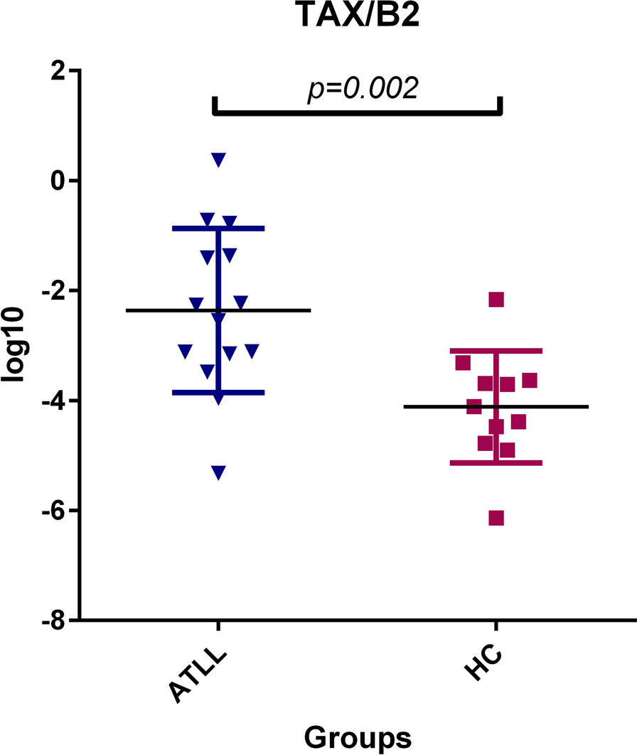 The role of CREB and MAPK signaling pathways in ATLL patients