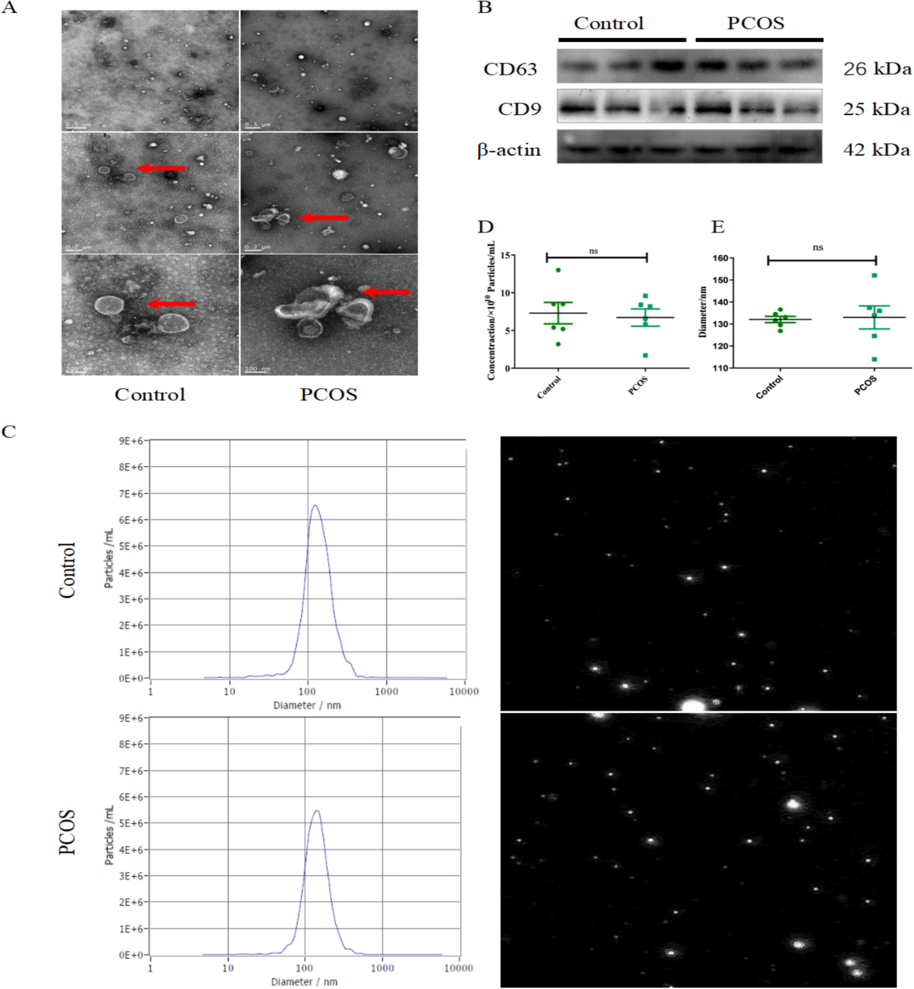 Follicular fluid-derived extracellular vesicles miR-34a-5p regulates granulosa cell glycolysis in polycystic ovary syndrome by targeting LDHA