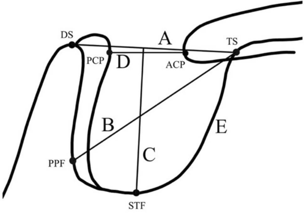 Radiological assessment of Sella Turcica morphology correlates with skeletal classes in an Austrian population: an observational study