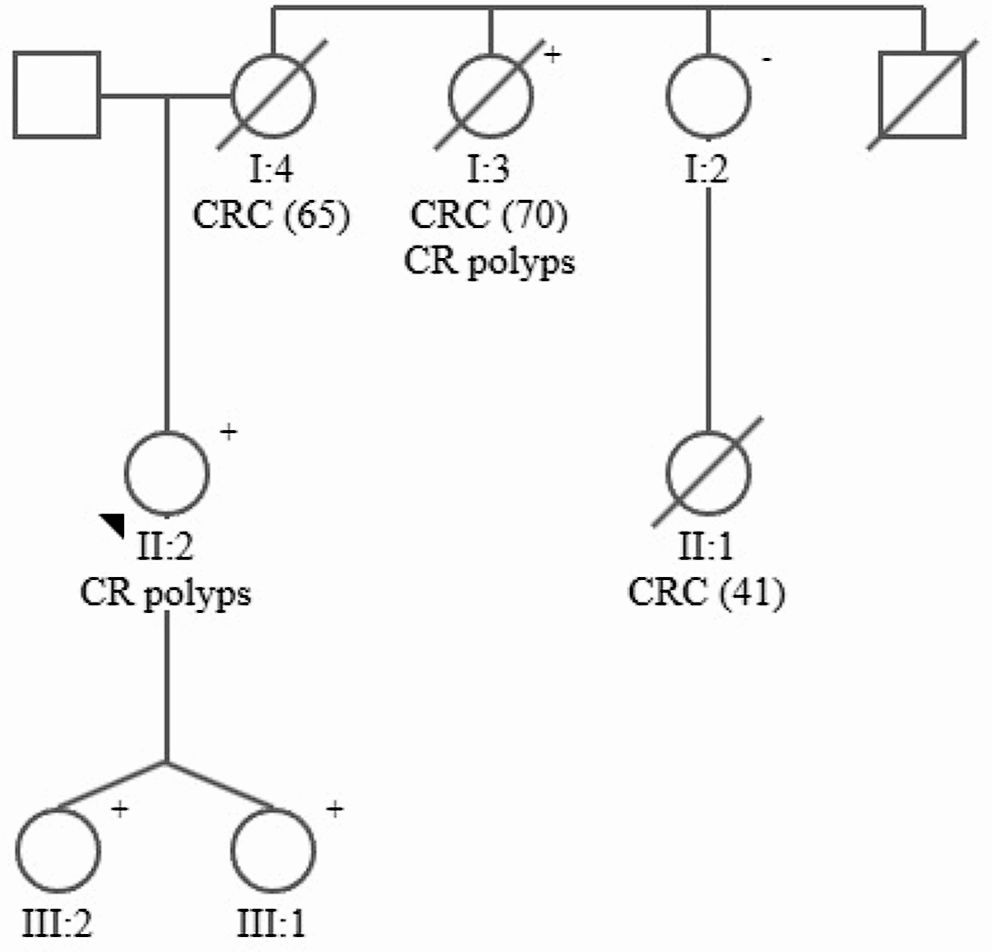 Germline pathogenic variants in RNF43 in patients with and without serrated polyposis syndrome