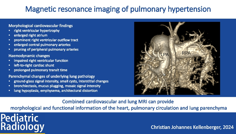 Magnetic resonance imaging of pulmonary hypertension