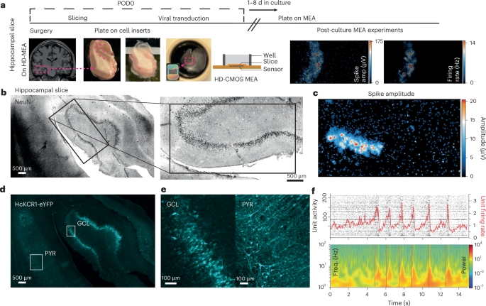 Multimodal evaluation of network activity and optogenetic interventions in human hippocampal slices